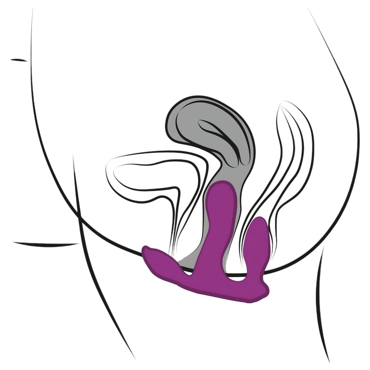 3Some total ecstasy - akkus, rádiós tripla vibrátor (lila)